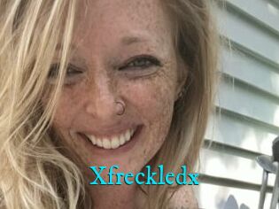 Xfreckledx